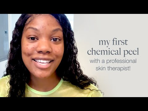 My first chemical peel with a professional skin therapist!
