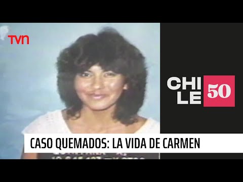 Caso Quemados: La vida de Carmen Gloria Quintana | #Chile50