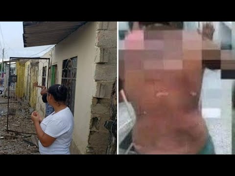 Mujer quemó a su yerno por ir a visitarla y pedirle comida sin avisar