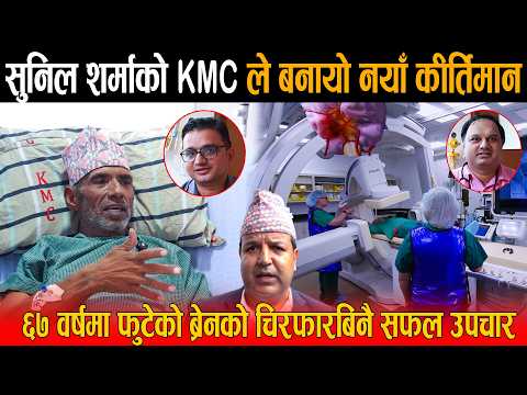 सुनिलको KMC ले रच्यो इतिहास: नेपालमै पहिलो पटक ६७ वर्षमा फुटेको ब्रेन एभीएमको चिरफारबिनै सफल उपचार