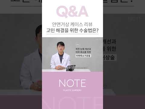 [이보형원장의 Q&A] 안면거상 케이스 리뷰, 고민 해결을 위한 수술방법은 ? #shorts