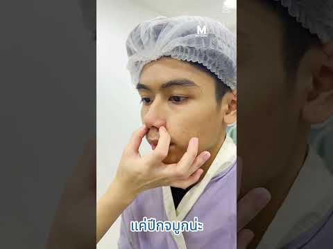 ตัดปีกจมูกเพื่อชีวิตใหม่เริ่ม