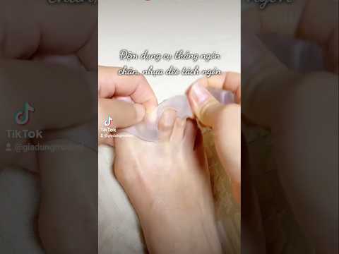 dụng cụ thẳng ngón chân, nhựa dẻo tách ngón #diachitongkho #giadung #khosigiadung #tongsigiadung