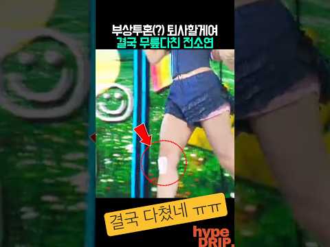퇴사할게여 무릎다친 <strong>전소연</strong>