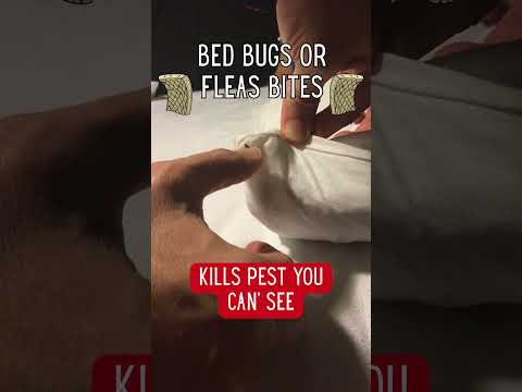 Flea Bites or Bed Bug Bites At Night? This Works Wonders