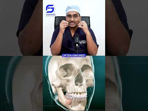 Jaw Tumors symptoms Diagnosis & Treatment #jawpain