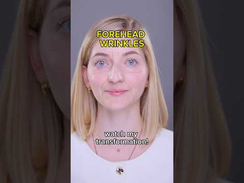 if you have smile lines, marionette lines, forehead wrinkles or eye bags, do this face fitness