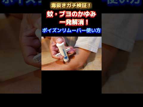 【虫刺され】ポイズンリムーバーの使い方！虫よけ対策グッズ