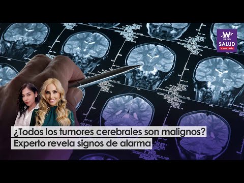 ¿Todos los tumores cerebrales son malignos? Experto revela signos de alarma | Salud y Algo Más