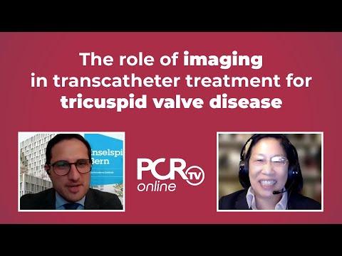 The role of imaging in transcatheter treatment for tricuspid valve disease