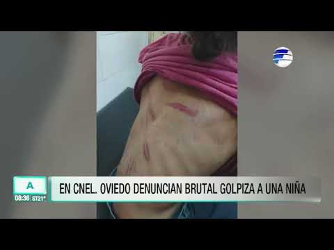 Denuncian brutal golpiza a una niña en Coronel Oviedo