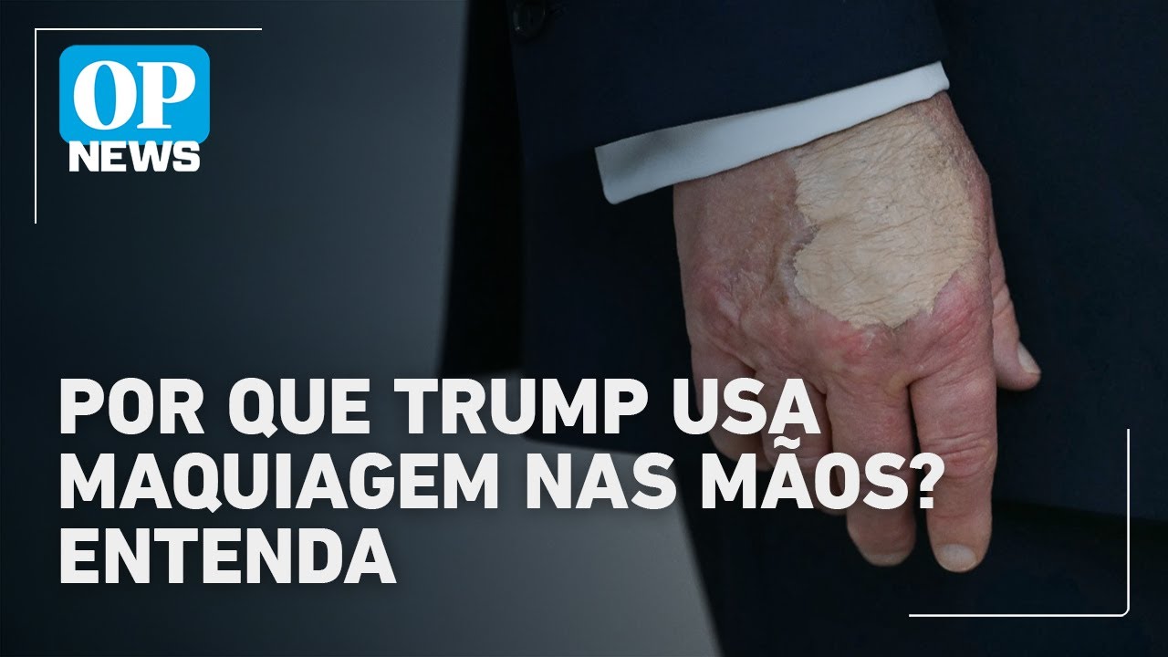 Saúde de Trump entenda a Insuficiência Venosa Crônica e o uso de maquiagem nas mãos | O POVO News