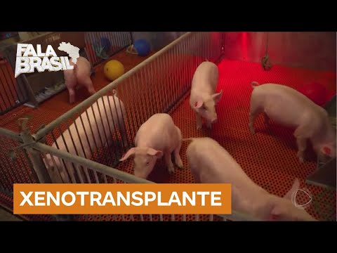 Boa Notícia: Cientistas estão otimistas com técnicas de transplante que usam porcos como doadores