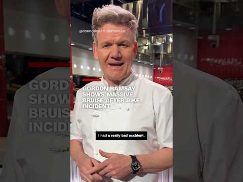 Gordon Ramsay shows massive bruise after bike incident