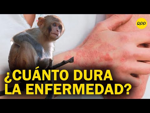 ¿Cuánto dura la enfermedad de la viruela del mono en desaparecer? ¿Se mantiene en el ambiente?