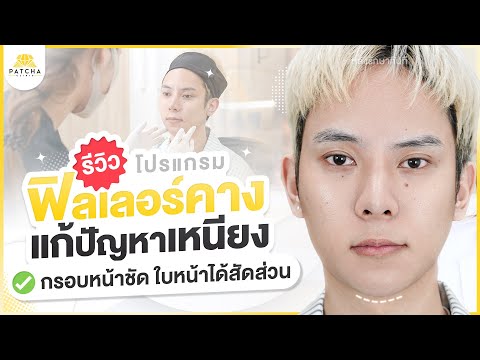 รีวิวฟิลเลอร์คางแก้ปัญหาเหนีย