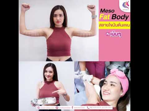 ไขมันหาย-ด้วยMeso-fat-ที่ยูนิค ไขมันหาย-ด้วยMeso-fat-ที่ยูนิค