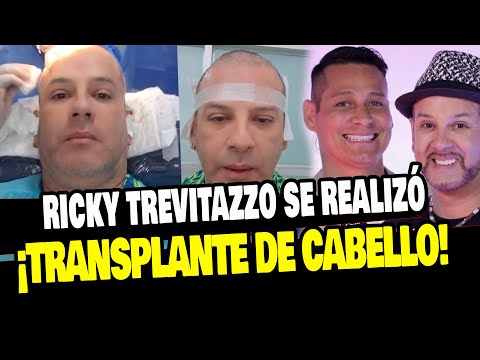 RICKY TREVITAZZO SE REALIZA TRANSPLANTE DE CABELLO TRAS QUEDARSE CALVO