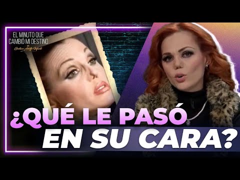 ¿Qué ocurrió con la nariz de Carmen Campuzano? | El Minuto que Cambió mi Destino