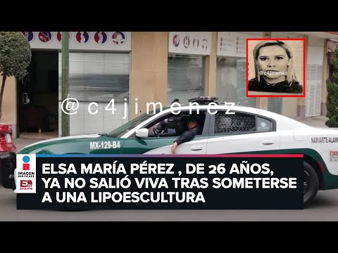 Venezolana, que prostituía a mujeres en la CDMX, muere durante una cirugía estética