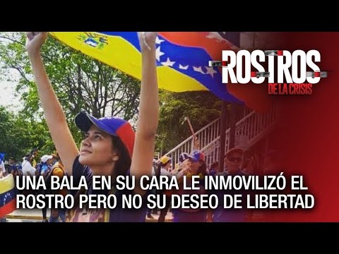 Una bala en su cara le inmovilizó el rostro pero no su deseo de libertad - Rostros de la Crisis