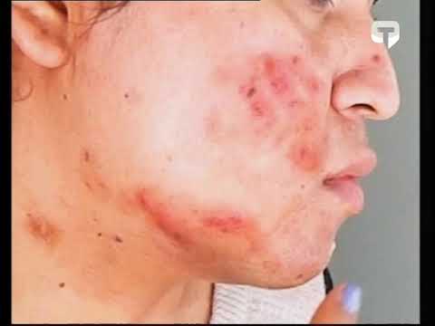Réplicas de maquillaje y los riesgos que puede causar en la piel