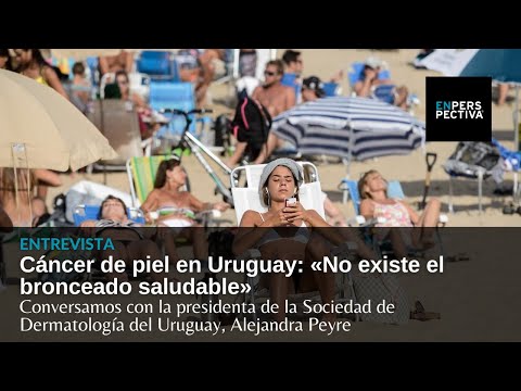 Cáncer de piel en Uruguay: «No existe el bronceado saludable» (Pdta. de la Sociedad de Dermatología)