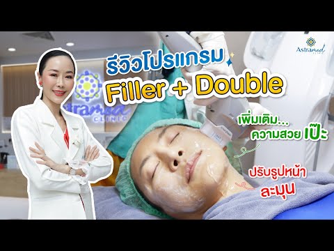 Astramed Clinic รีวิวโปรแกรมFiller+DoubleUltraLifting🩵🤩