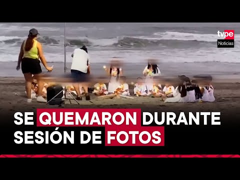 San Borja: niños de inicial sufren graves quemaduras durante sesión de fotos en la playa